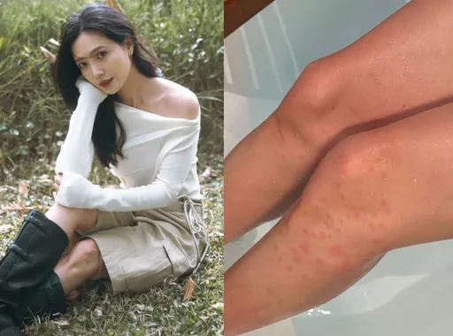 吳子霏闖森林秘境拍形象照　「露美腿」慘變小黑蚊頭號目標