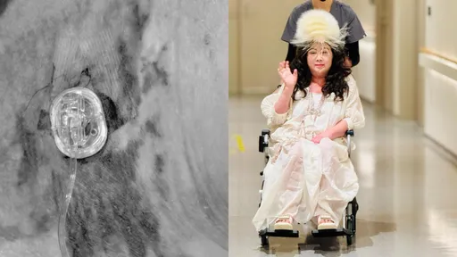 陳文茜癌末反覆感染「手術失敗」　醫崩潰喊3次：太難了…