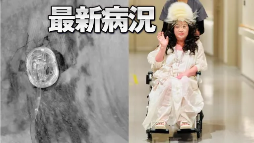 陳文茜癌末反覆感染「手術失敗」　醫崩潰喊3次：太難了…