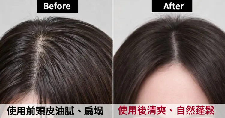 使用前頭皮不只油，還容易扁塌無型，使用後頭頂的蓬鬆度立馬大加分。