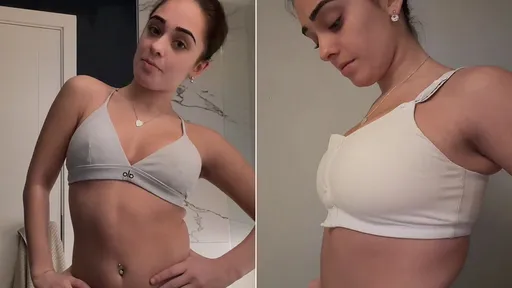 縮胸手術求A罩杯「奶奶又回來了」　年輕妹子決定再切一次