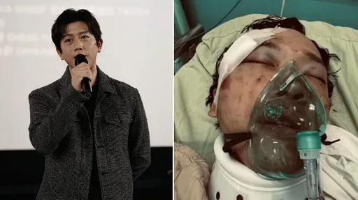  影帝莫子儀心疼替身好友受重傷！盼電視台、劇組負起責任