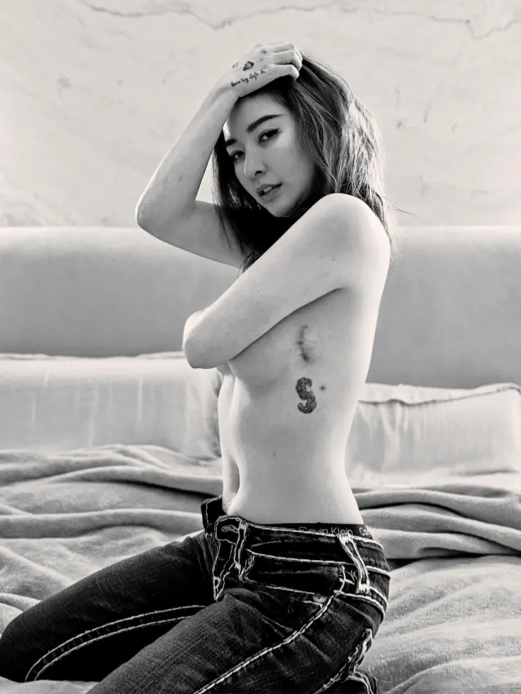 許維恩大方坦露切乳傷疤。翻攝許維恩IG