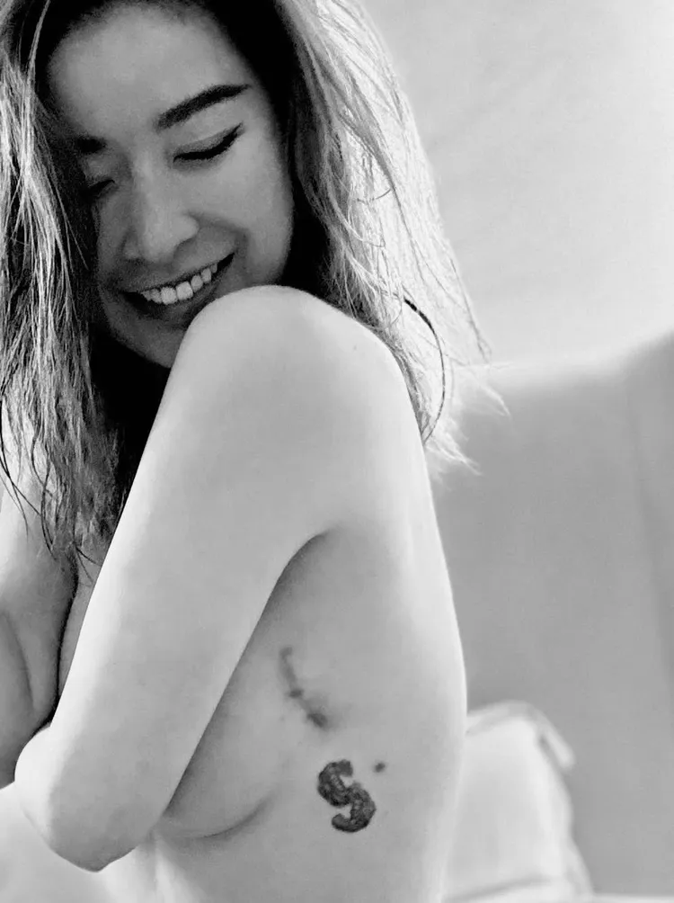 許維恩表示「每一道疤痕，都是人生送給我們的勳章。」翻攝許維恩IG