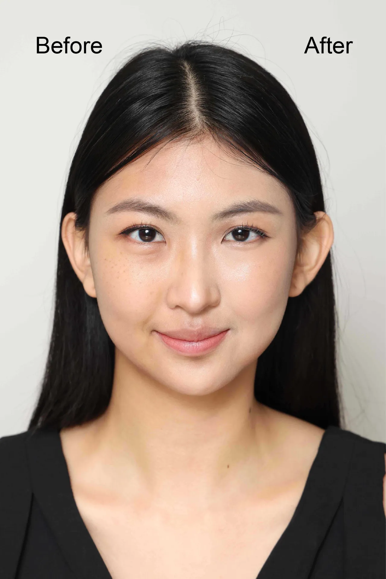 M.A.C無針水光嫩肌術 Before & After。品牌提供