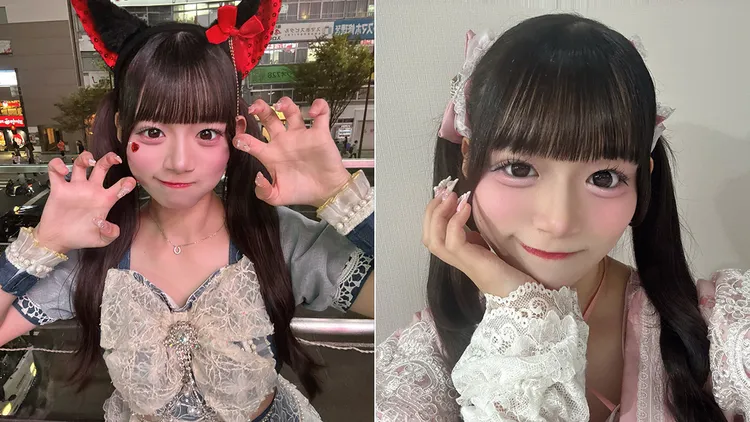 Noa。翻攝自Noa X