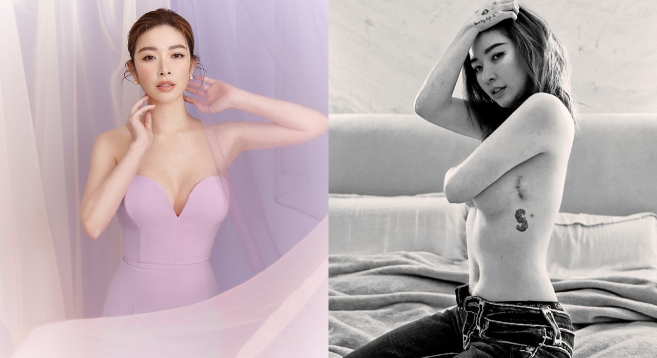 許維恩效應!乳房門診病患暴增1倍 OL:自己身體自己顧