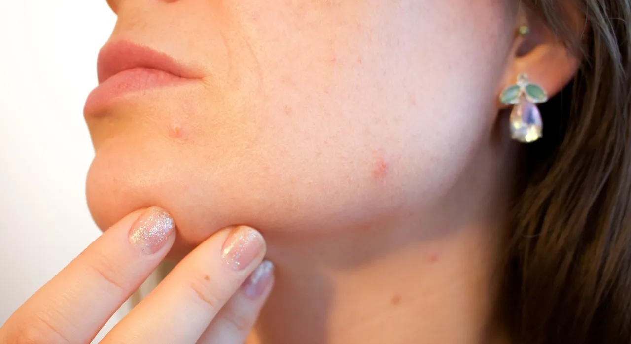 臉上7徵兆恐罹糖尿病　眼周浮腫、長斑都是警訊