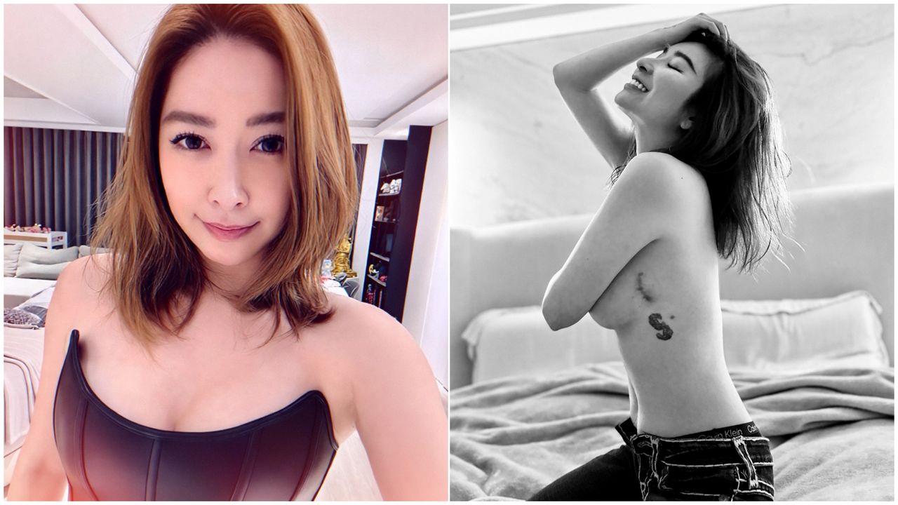 許維恩抗癌PO照「露點了」 急刪自嘲:原來我這麼自在