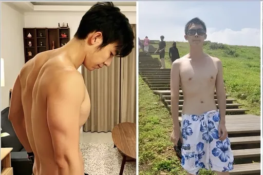 減重名醫罹糖尿病前期！他靠1招「不需減重」就逆轉