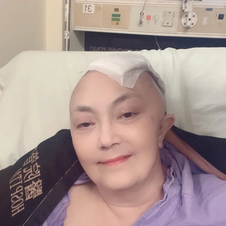 施明2022年12月在家中跌倒重創頭部，送醫開顱治療。翻攝施明臉書