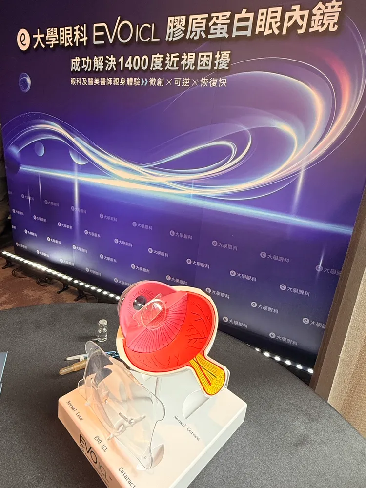 EVO ICL採用瑞士專利Collamer®膠原蛋白聚合物材質，屬於醫療級聚合物技術，含有高度親水性的膠原蛋白成分，具有柔軟、透明與穩定等特性，生物相容性高，更接近人體組織環境。陳揚盛攝