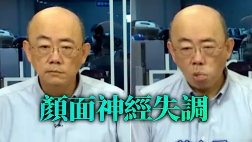 郭正亮上節目突「眼歪嘴斜」　觀眾心驚！主持人證實他病情