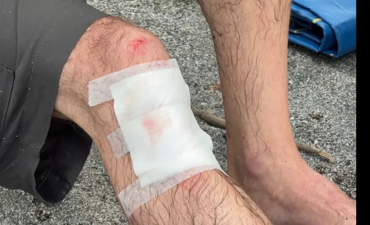 雷森救人時遭礁岩割傷。翻攝畫面