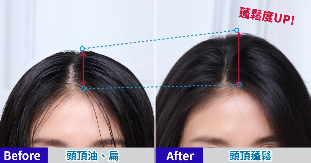 改善頭皮油膩的問題，頭頂蓬鬆度UPUP，十分清爽。 