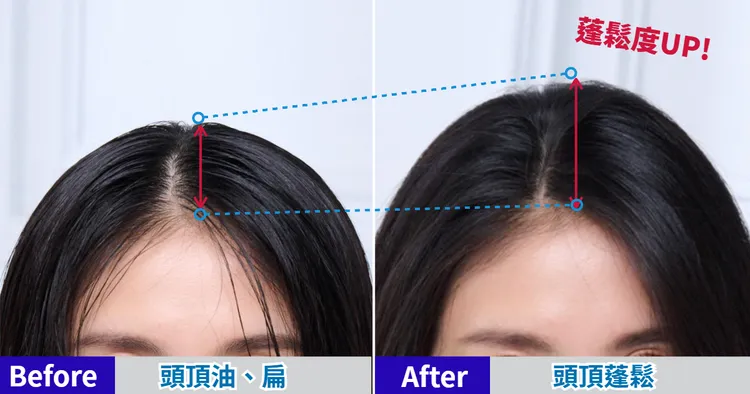 改善頭皮油膩的問題，頭頂蓬鬆度UPUP，十分清爽。 