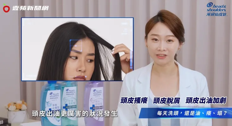 頭皮油水不平衡時，就會出現像是頭皮癢、頭皮屑、頭皮出油狀況加劇等問題。 