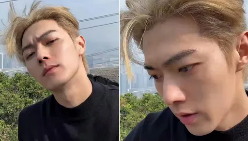 許凱帥臉縫8針手術一半麻醉退了！強忍痛苦　素顏曝現況