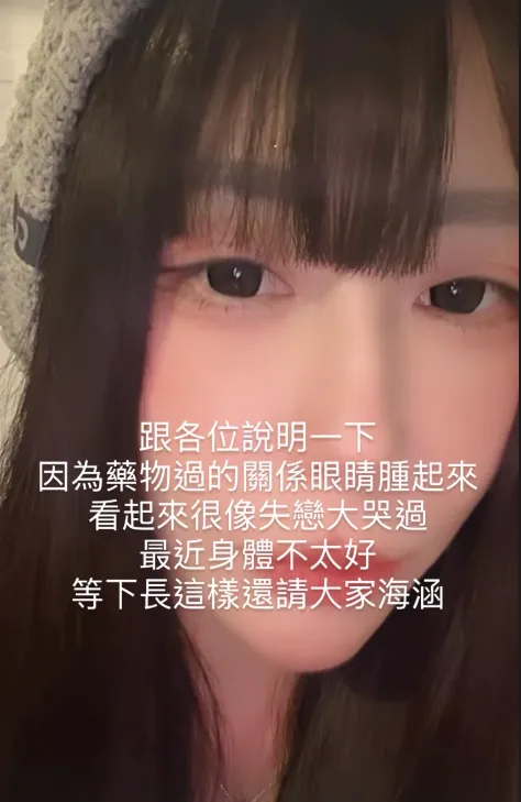 梓梓最近過敏，眼睛發腫。翻攝梓梓IG