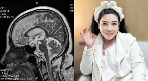 陳文茜曬腦部MRI「如藝術品般乾淨」 68歲生日前夕吐露心境