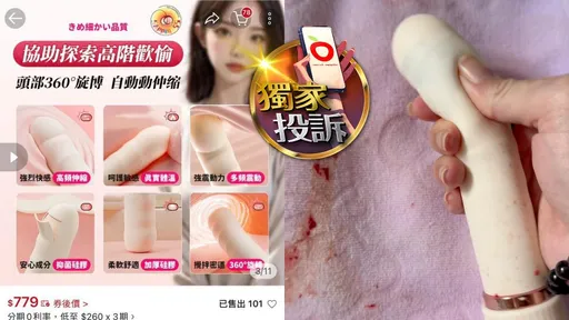 獨家投訴｜按摩棒斷頭「私密處爆血」！賣家稱買到機王　蝦皮說話了