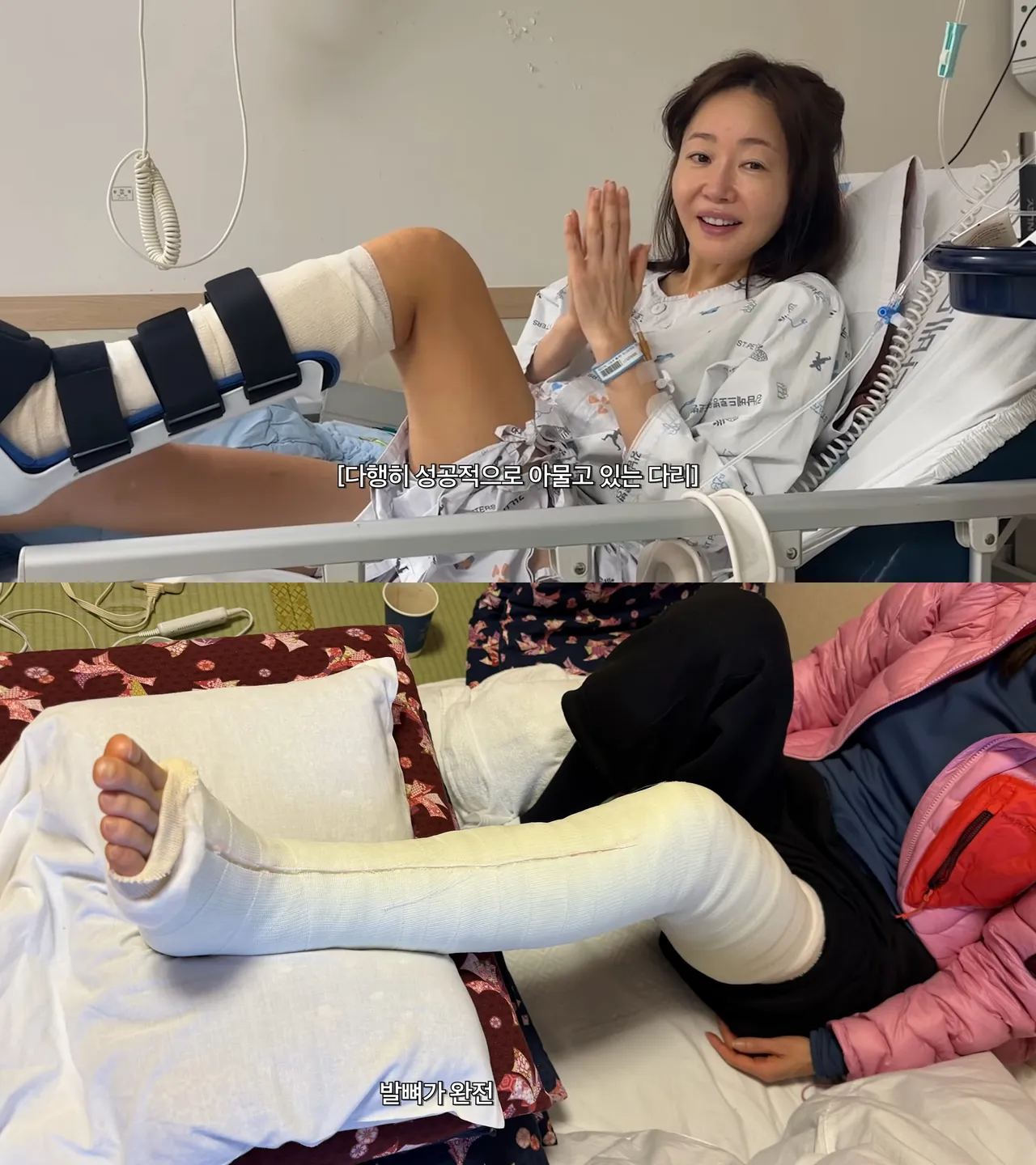 嚴志媛透露角的大骨頭、小骨頭都碎掉了。翻攝YouTube