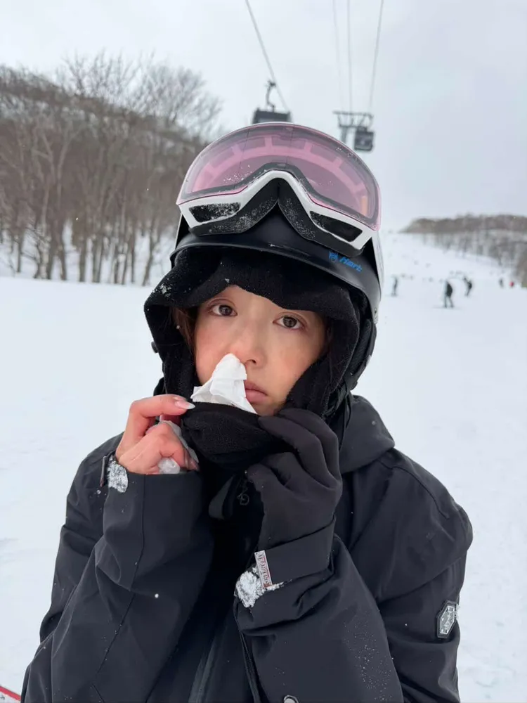 黃薇渟用衛生棉止血。黃薇渟提供