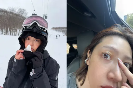 黃薇渟日本滑雪大噴血！鼻孔塞衛生棉急救　還原驚恐瞬間