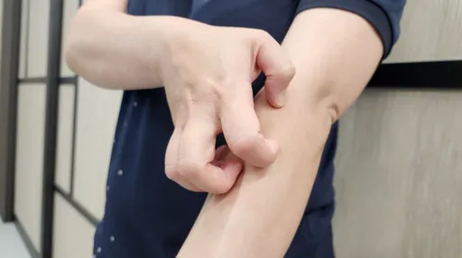 台北再爆麻疹境外移入！164人列管　這些足跡重疊快自我監測