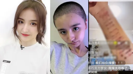 《青你2》金子涵悚露手臂傷痕　稱遭監控：不聽話就頭痛