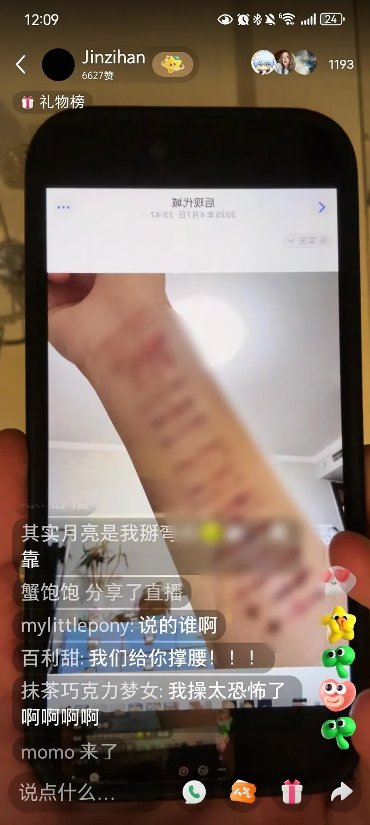 金子涵秀出手機裡的手臂傷痕照，嚇壞網友。翻攝小紅書