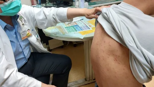 打疫苗仍得水痘　7歲童劇烈腹痛「引發腦炎」！醫示警1症狀別輕忽