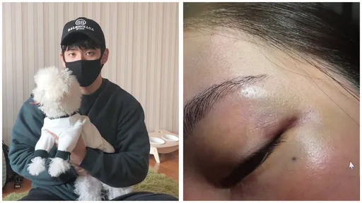 韓知名女團成員親哥再爆家醜！妻子曬傷痕照　揭性虐、逼吞Ｘ