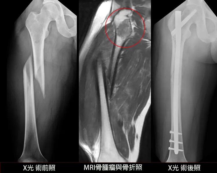 術前術後對照圖。光田提供