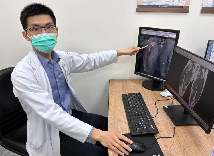 光田綜合醫院楊鎮源部長先確認腫瘤為良性，再進行刮除、復位手術。光田提供