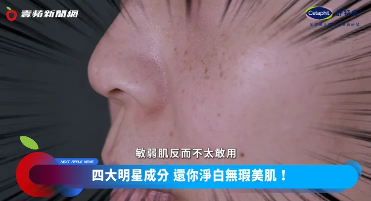 想要改善臉上的斑斑點點，加上敏弱肌，使用的保養品更需要慎選。