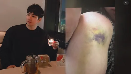 Jisoo大嫂遇家暴提離婚遭毒打！親哥家裝監視器監控威脅「把妳送進監獄」