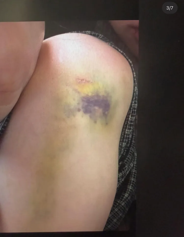 金正勳的妻子每天被家暴、監控，身心受創。翻攝theqoo