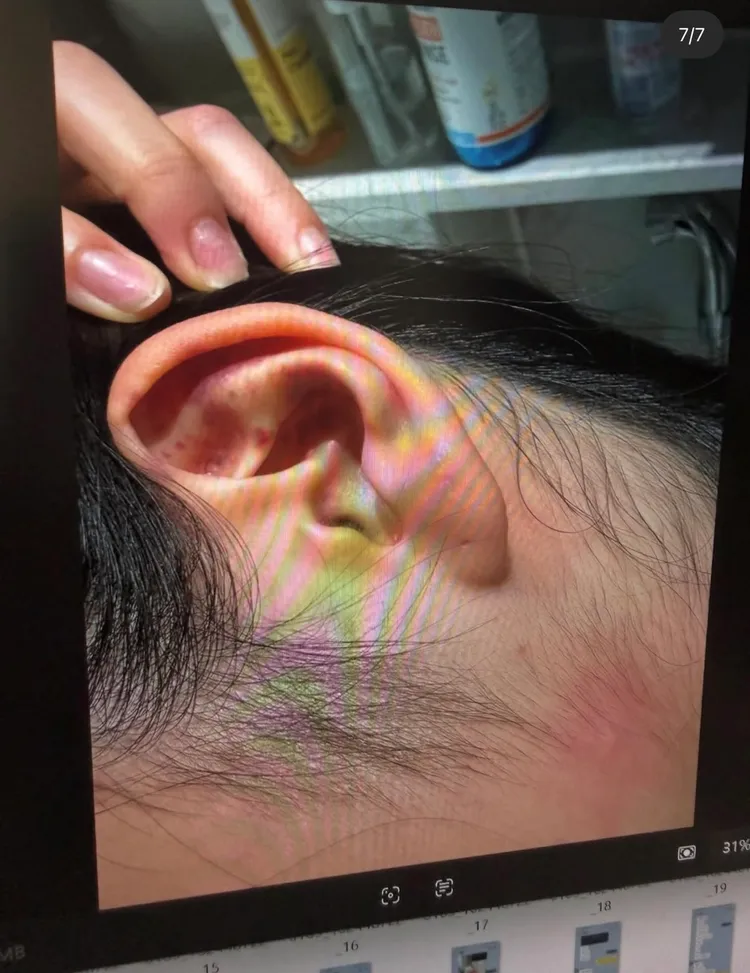 Jisoo大嫂被丈夫金正勳毆打驗傷照。翻攝theqoo