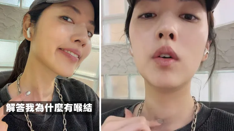 阿諾頸部長出甲狀腺結節，看起來像喉結，她已經動消融手術解決它。翻攝阿諾IG