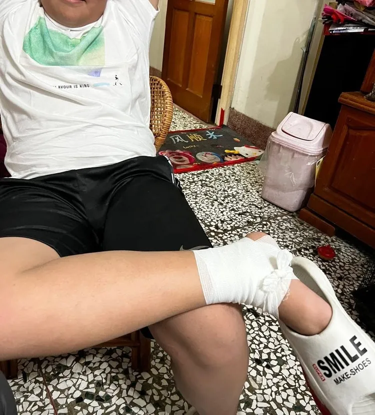 國中生手腳多處受傷。賴清美提供