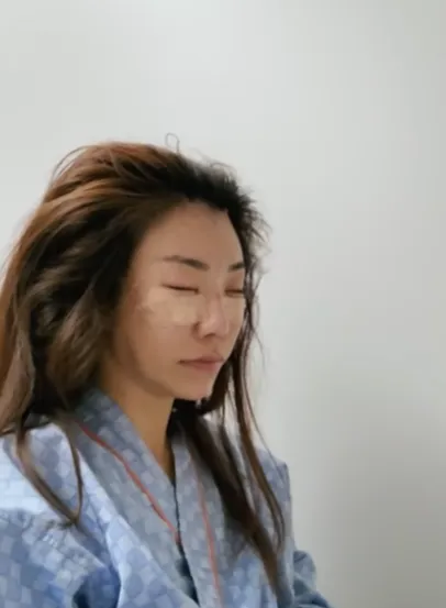剛做完手術時模樣。翻攝我是江老師YT