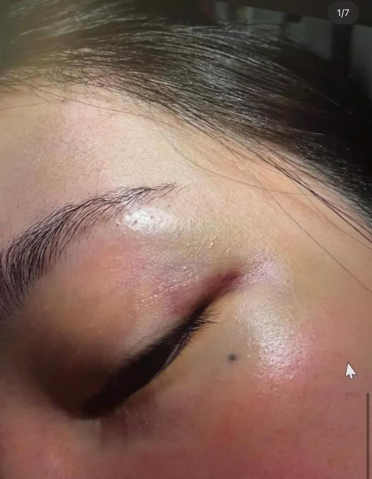 聲稱Jisoo大嫂的女子貼出臉部瘀青照佐證。翻攝theqoo