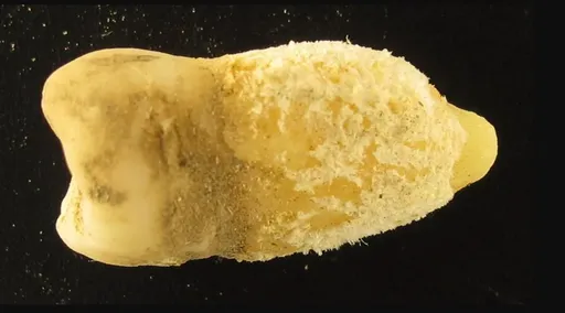 700年木乃伊翻案　這些病菌早在美洲流傳