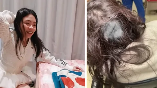 二伯臥室滑倒後腦勺撞窗頭破血流！蔡阿嘎擔心被誤當家暴