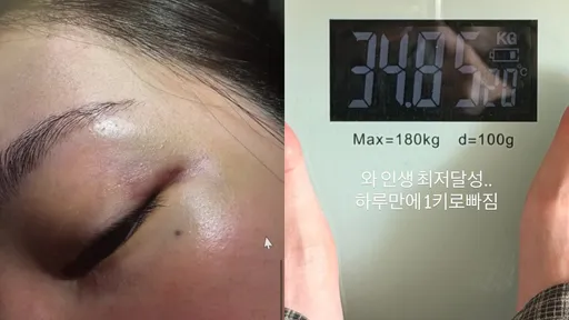 Jisoo大嫂遭家暴瘦到34公斤！曝父母不願事情鬧大「好想死了算了」