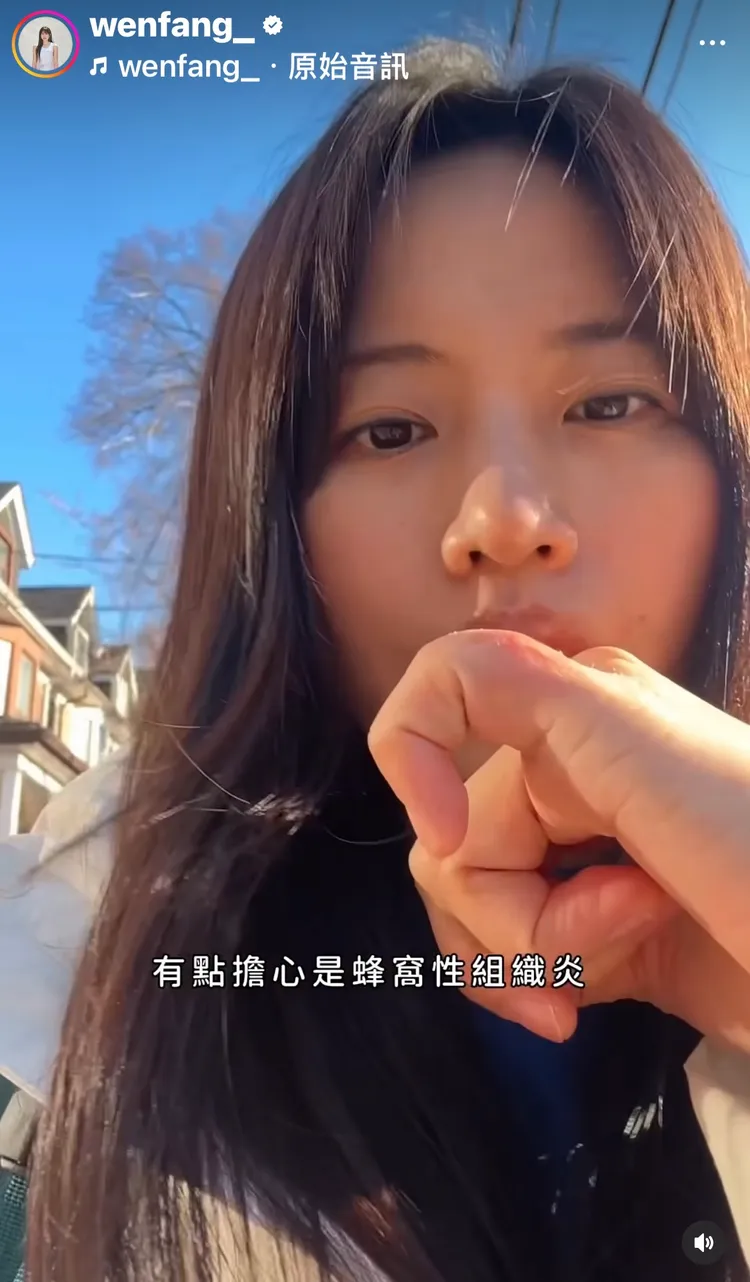 吳汶芳因小拇指關節潰爛紅腫，急在加拿大就醫。翻攝IG