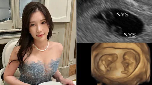 鄭家純要當媽了！開心宣布懷了「同卵雙胞胎」已12周