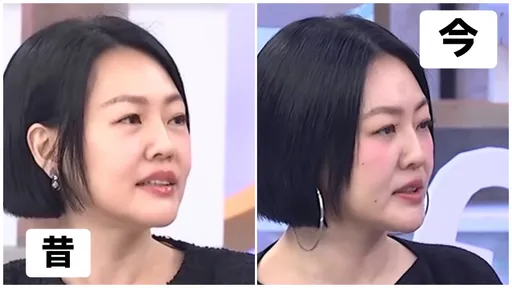 小S復出「臉多2顆痣」！網瞎猜求改運？　經紀人解答了