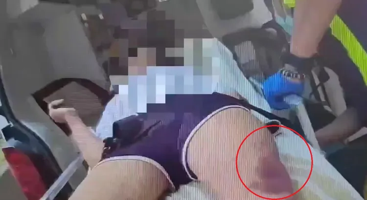 被害人陳女腿部出現大面積瘀傷。翻攝照片